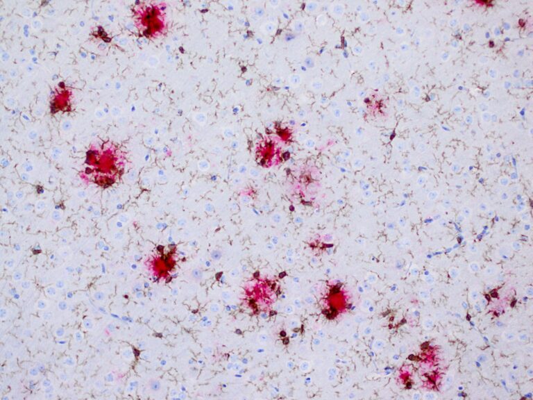 Mikroglia Plaque1 768x576
