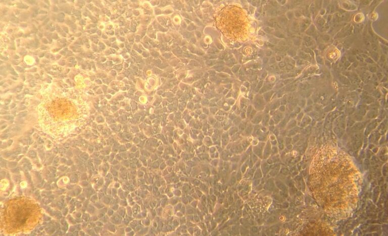 islet organoids sm1 768x468
