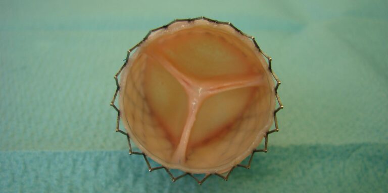 synthetic20heart20valve1 768x383